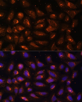 CKMT1B Antibody