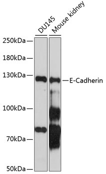 E-Cadherin Antibody