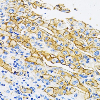 MCT1 Antibody