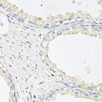 EPOR Antibody
