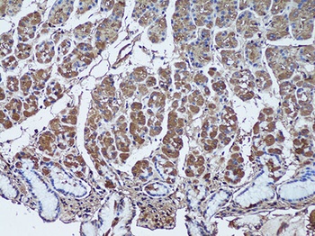 SFRP1 Antibody