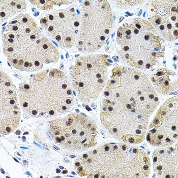 EIF4G2 Antibody
