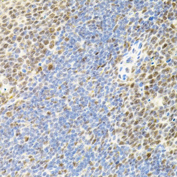 EIF4G2 Antibody