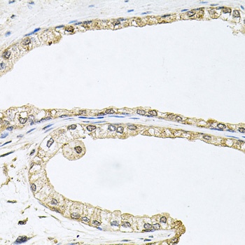 CDK1 Antibody