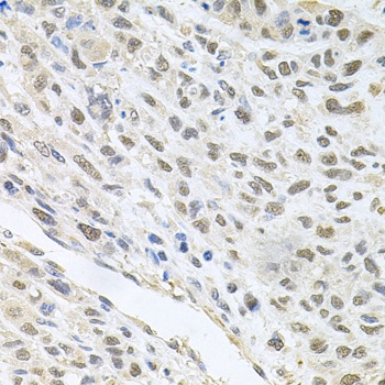 CDK1 Antibody