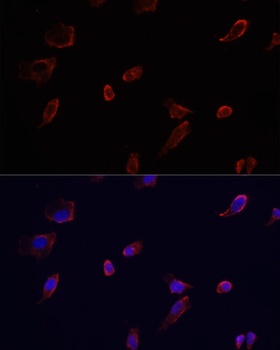 AQP3 Antibody