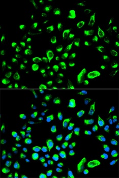 YWHAQ Antibody