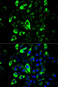 GZMB Antibody