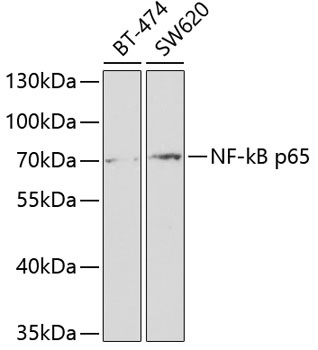 NF-kB p65 Antibody