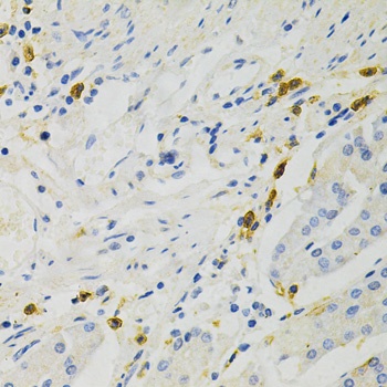 NF-kB p65 Antibody