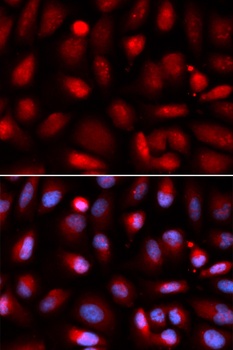 NF-kB p65 Antibody