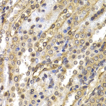 NEDD9 Antibody