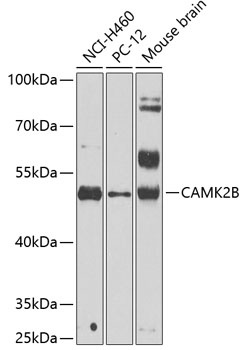 CAMK2B Antibody