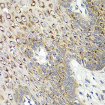 CDK1 Antibody