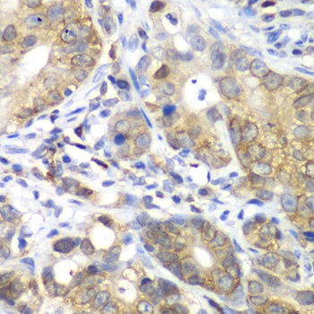 CDK1 Antibody