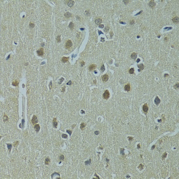 UBE2I Antibody
