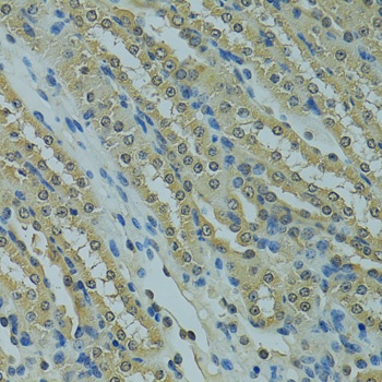 UBE2I Antibody