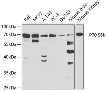 P70 S6K Antibody