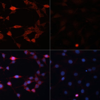 P70 S6K Antibody