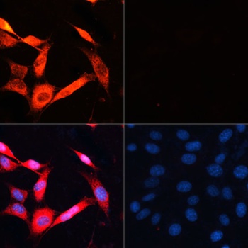 P70 S6K Antibody