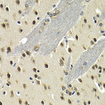 MAX Antibody