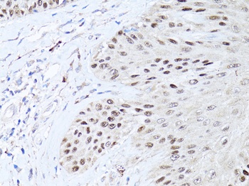 TP63 Antibody
