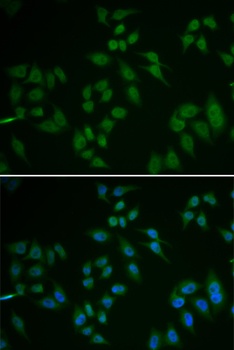 TP63 Antibody