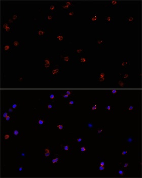 PTPRC Antibody