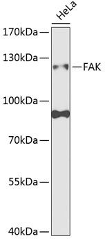 FAK Antibody
