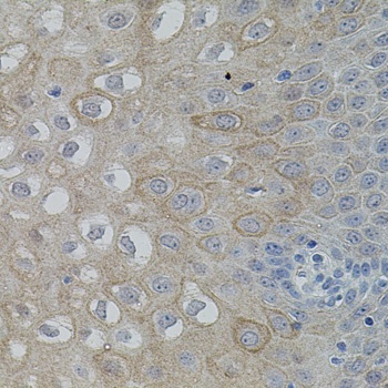 FAK Antibody