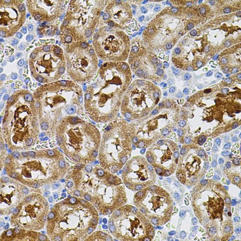 FAK Antibody