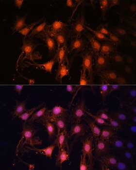 E2F1 Antibody
