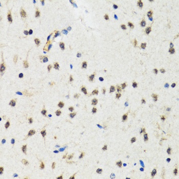 IKK alpha Antibody