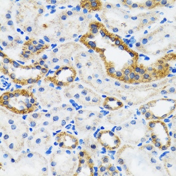 IKK alpha Antibody