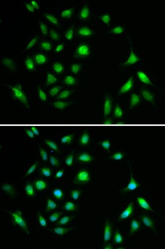 IKK alpha Antibody