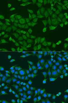RPS27A Antibody