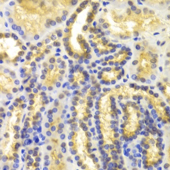 EIF5A Antibody
