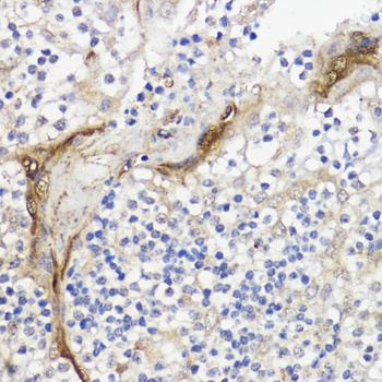 BMPR1B Antibody