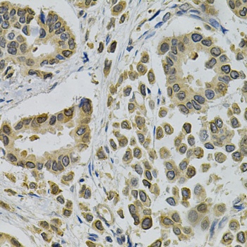 EBAG9 Antibody