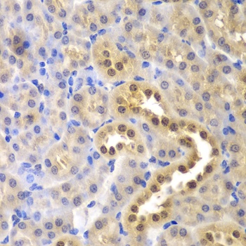 GLO1 Antibody
