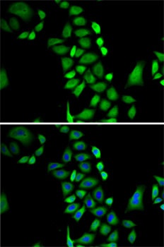GLO1 Antibody