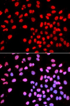 IKZF1 Antibody