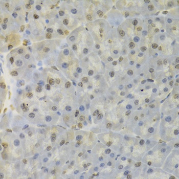 HNRNPD Antibody