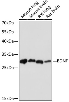 BDNF Antibody [10B3D3]