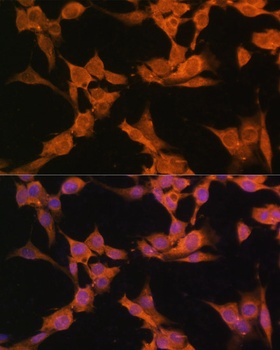 CAMK2A Antibody