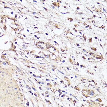 VEGF Antibody [5E5E3]