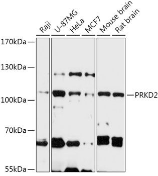 PRKD2 Antibody