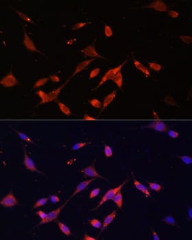 PIK3R2 Antibody