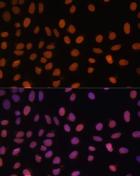 Lamin A / C Antibody