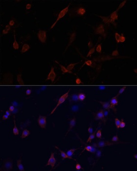 CFL1 Antibody
